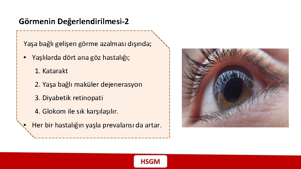 Görmenin Değerlendirilmesi-2 Yaşa bağlı gelişen görme azalması dışında; • Yaşlılarda dört ana göz hastalığı;