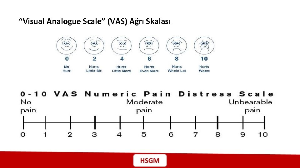 “Visual Analogue Scale” (VAS) Ağrı Skalası 