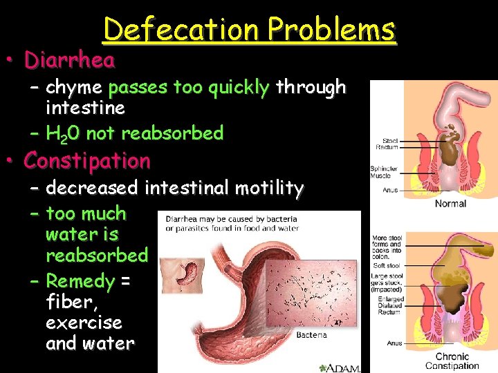 Defecation Problems • Diarrhea – chyme passes too quickly through intestine – H 20
