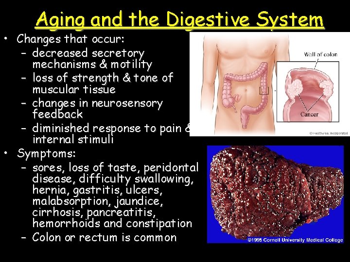 Aging and the Digestive System • Changes that occur: – decreased secretory mechanisms &