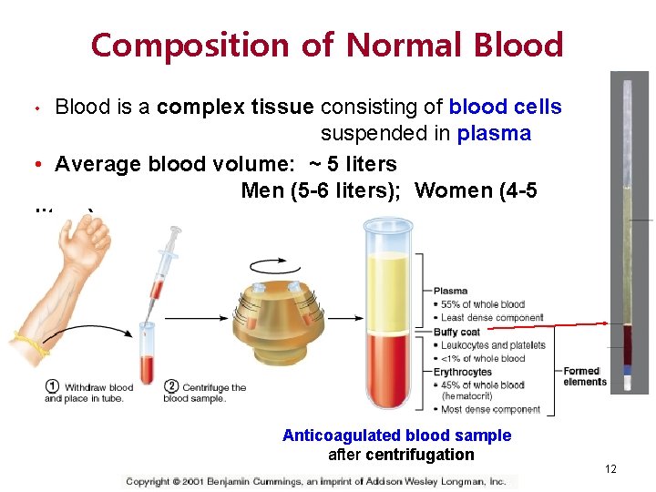 Composition of Normal Blood is a complex tissue consisting of blood cells suspended in