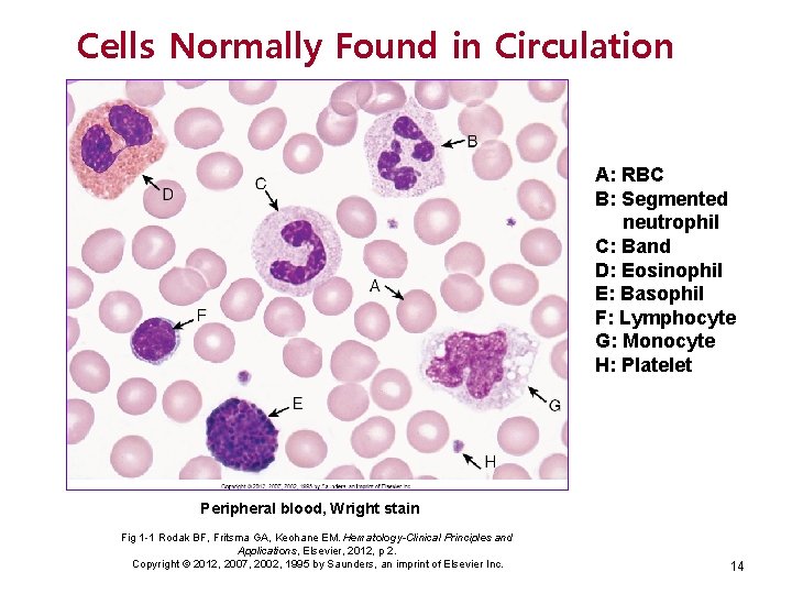 Cells Normally Found in Circulation A: RBC B: Segmented neutrophil C: Band D: Eosinophil