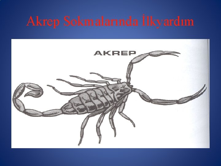 Akrep Sokmalarında İlkyardım 