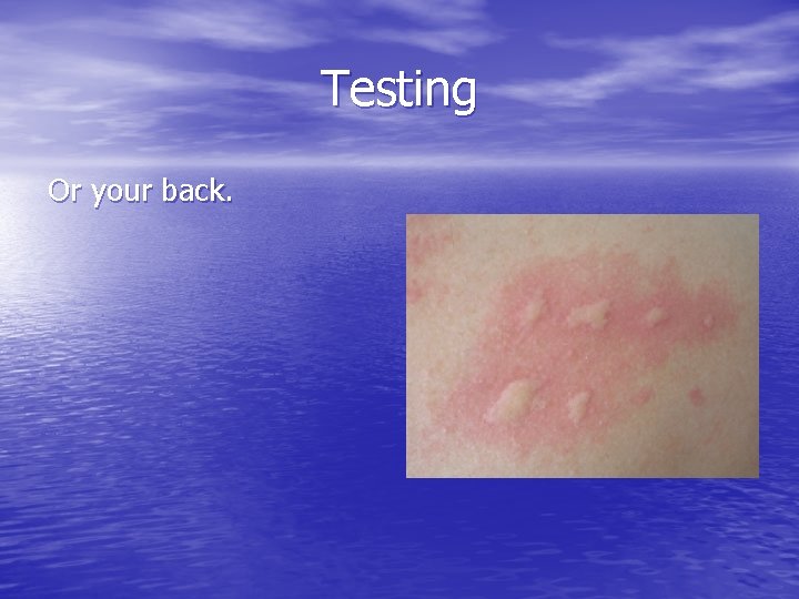 Testing Or your back. 