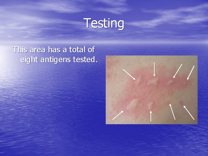 Testing This area has a total of eight antigens tested. 