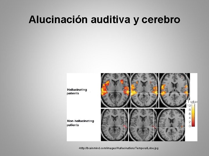 Alucinación auditiva y cerebro • http: //brainmind. com/images/Hallucinations. Temporal. Lobe. jpg 