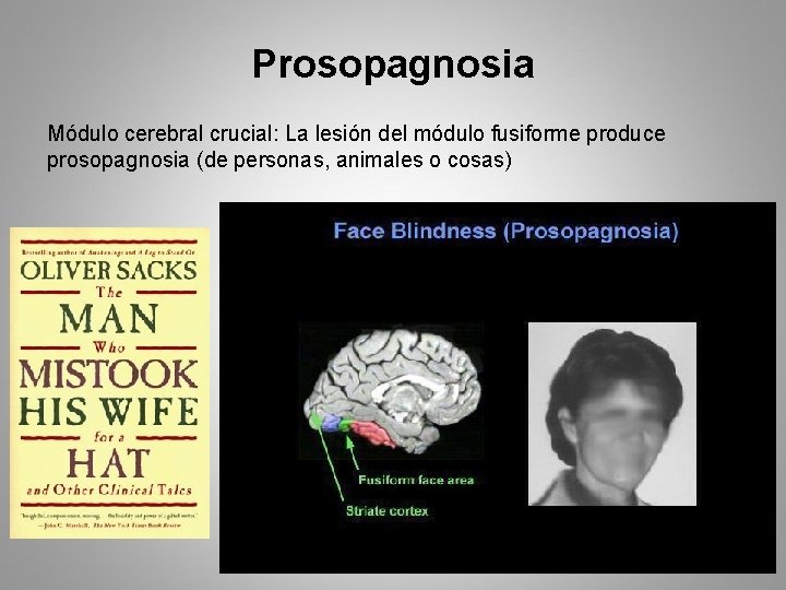 Prosopagnosia Módulo cerebral crucial: La lesión del módulo fusiforme produce prosopagnosia (de personas, animales