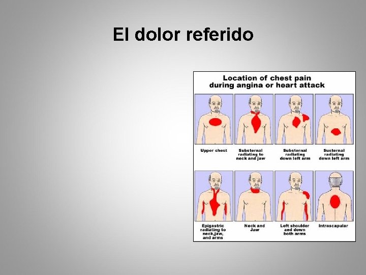 El dolor referido 