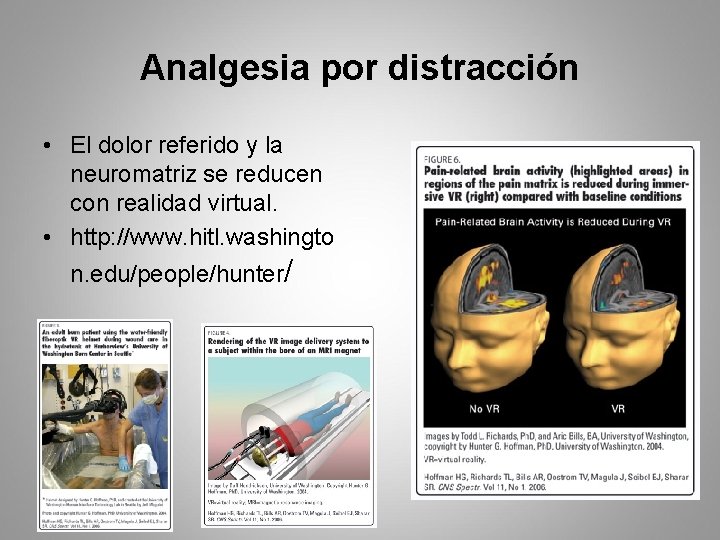 Analgesia por distracción • El dolor referido y la neuromatriz se reducen con realidad