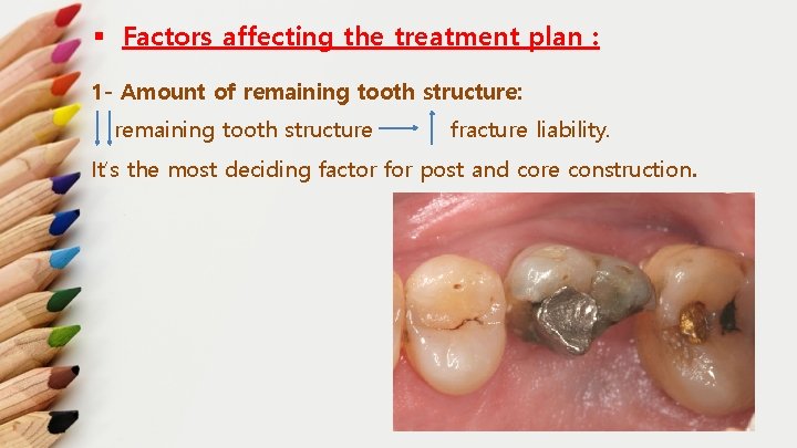 § Factors affecting the treatment plan : 1 - Amount of remaining tooth structure: