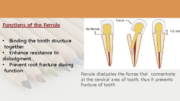 Functions of the Ferrule • Binding the tooth structure together • Enhance resistance to