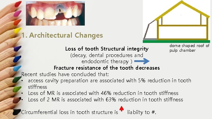 1. Architectural Changes dome shaped roof of pulp chamber Loss of tooth Structural integrity