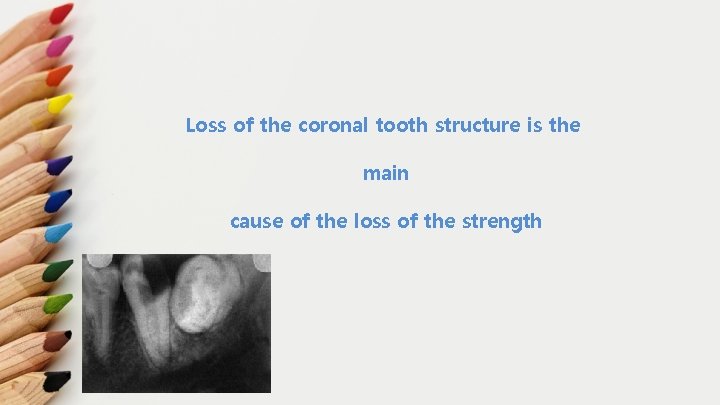 Loss of the coronal tooth structure is the main cause of the loss of
