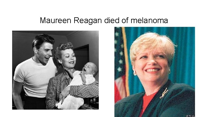 Maureen Reagan died of melanoma 