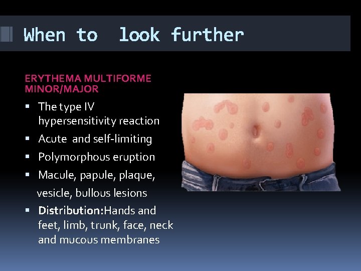 When to look further ERYTHEMA MULTIFORME MINOR/MAJOR The type IV hypersensitivity reaction Acute and