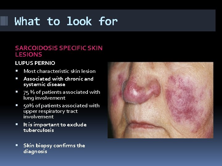 What to look for SARCOIDOSIS SPECIFIC SKIN LESIONS LUPUS PERNIO Most characteristic skin lesion