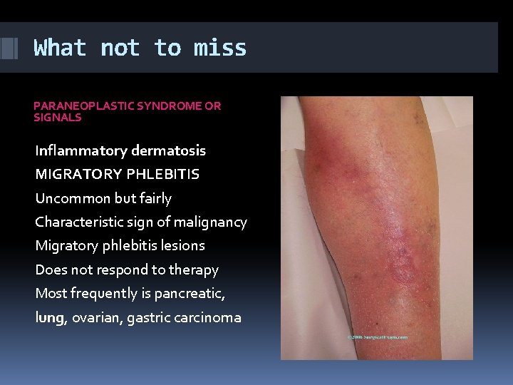 What not to miss PARANEOPLASTIC SYNDROME OR SIGNALS Inflammatory dermatosis MIGRATORY PHLEBITIS Uncommon but