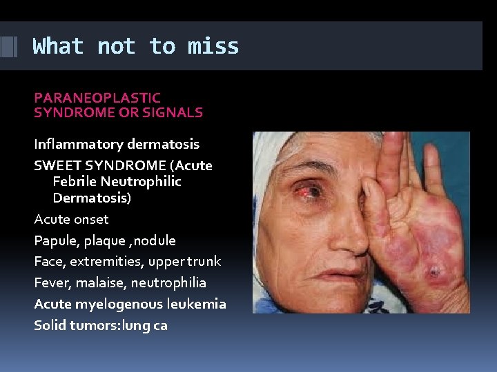 What not to miss PARANEOPLASTIC SYNDROME OR SIGNALS Inflammatory dermatosis SWEET SYNDROME (Acute Febrile