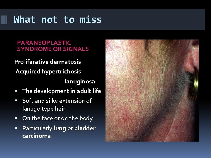What not to miss PARANEOPLASTIC SYNDROME OR SIGNALS Proliferative dermatosis Acquired hypertrichosis lanuginosa The