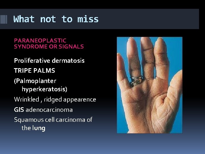 What not to miss PARANEOPLASTIC SYNDROME OR SIGNALS Proliferative dermatosis TRIPE PALMS (Palmoplanter hyperkeratosis)