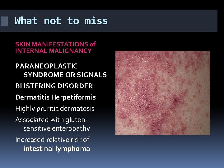 What not to miss SKIN MANIFESTATIONS of INTERNAL MALIGNANCY PARANEOPLASTIC SYNDROME OR SIGNALS BLISTERING