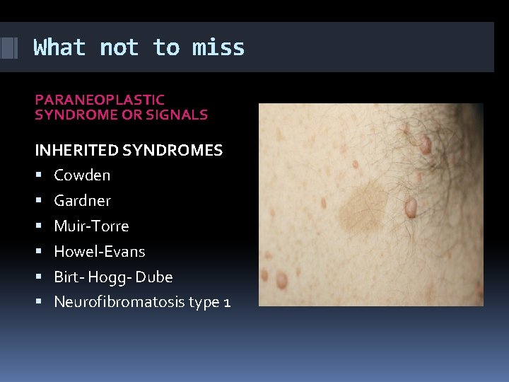 What not to miss PARANEOPLASTIC SYNDROME OR SIGNALS INHERITED SYNDROMES Cowden Gardner Muir-Torre Howel-Evans