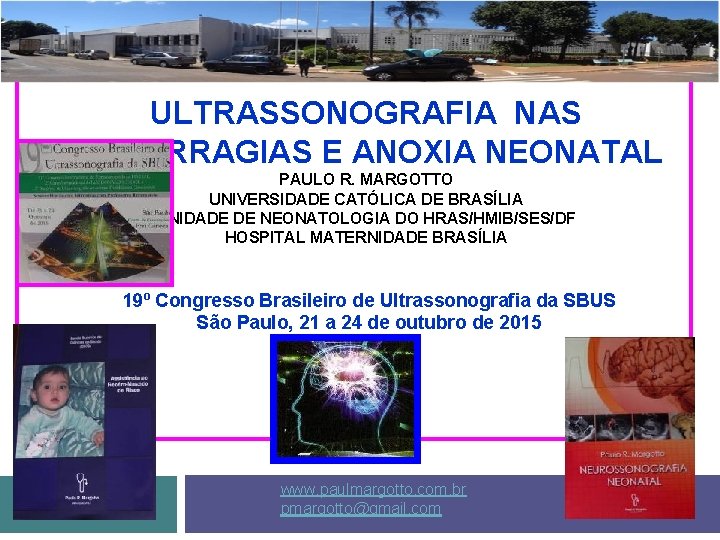 ULTRASSONOGRAFIA NAS HEMORRAGIAS E ANOXIA NEONATAL PAULO R. MARGOTTO UNIVERSIDADE CATÓLICA DE BRASÍLIA UNIDADE