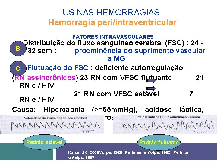 US NAS HEMORRAGIAS Hemorragia peri/intraventricular FATORES INTRAVASCULARES Distribuição do fluxo sanguíneo cerebral (FSC) :