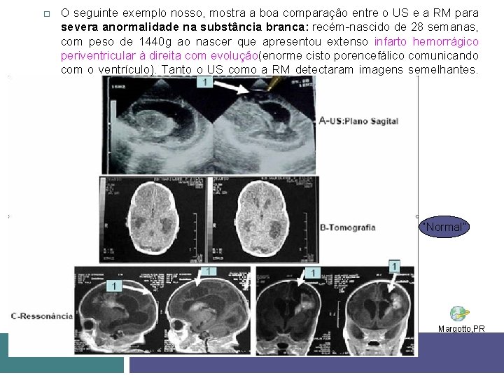  O seguinte exemplo nosso, mostra a boa comparação entre o US e a