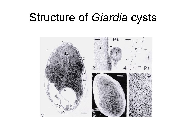 Structure of Giardia cysts 