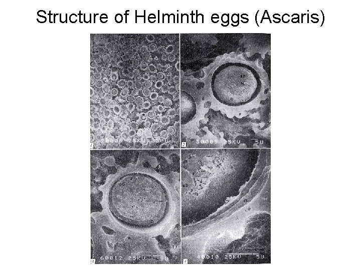 Structure of Helminth eggs (Ascaris) 