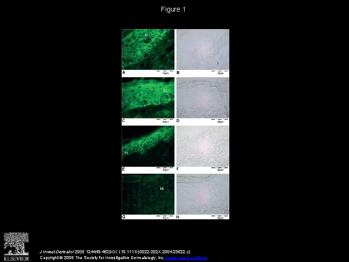 Figure 1 J Invest Dermatol 2005 124443 -452 DOI: (10. 1111/j. 0022 -202 X.