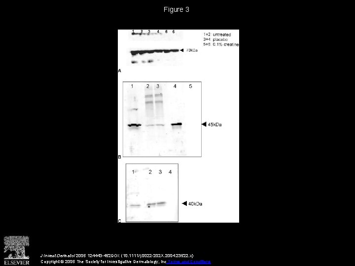 Figure 3 J Invest Dermatol 2005 124443 -452 DOI: (10. 1111/j. 0022 -202 X.