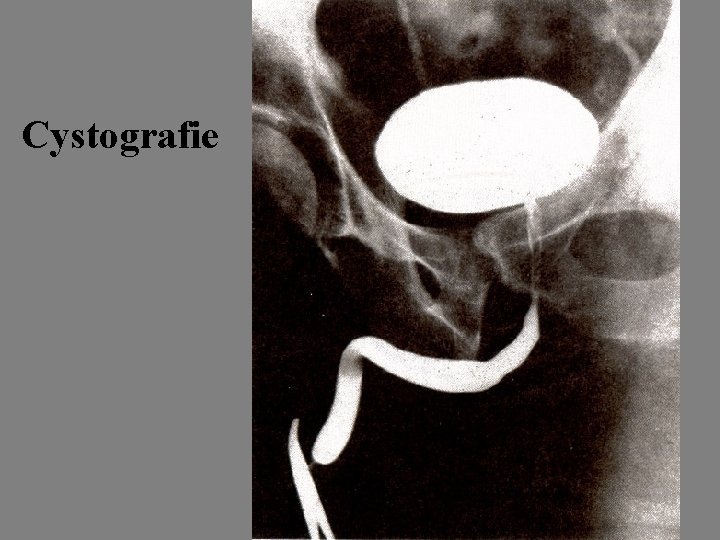Cystografie 