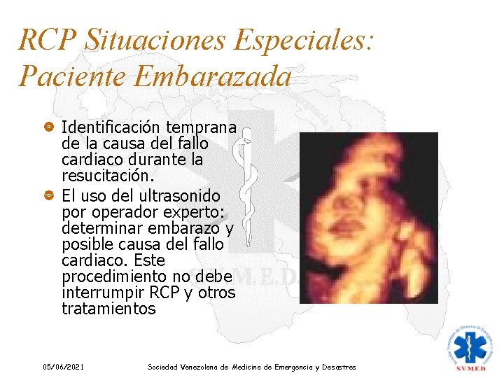 RCP Situaciones Especiales: Paciente Embarazada Identificación temprana de la causa del fallo cardiaco durante