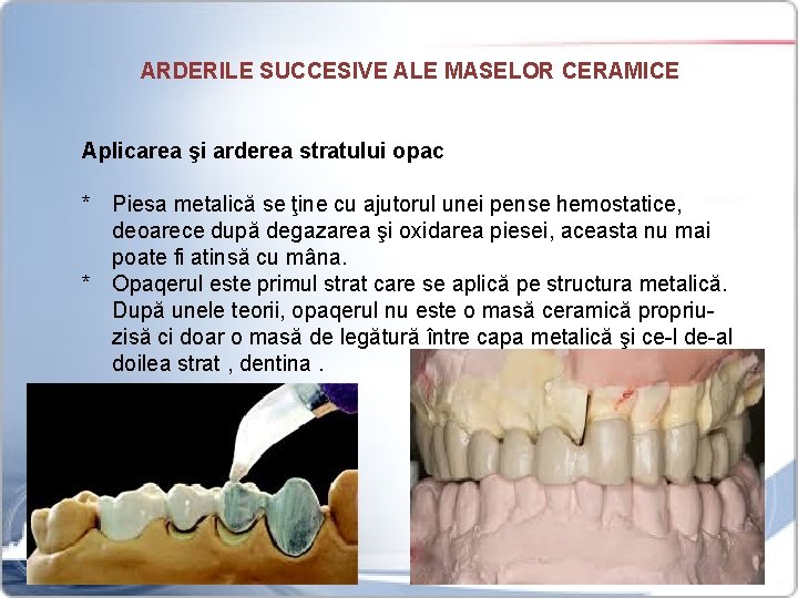 ARDERILE SUCCESIVE ALE MASELOR CERAMICE Aplicarea şi arderea stratului opac * Piesa metalică se