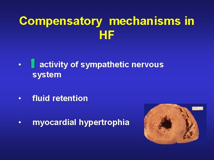 Compensatory mechanisms in HF • activity of sympathetic nervous system • fluid retention •