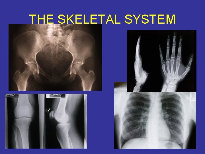 THE SKELETAL SYSTEM 