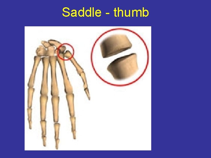 Saddle - thumb 