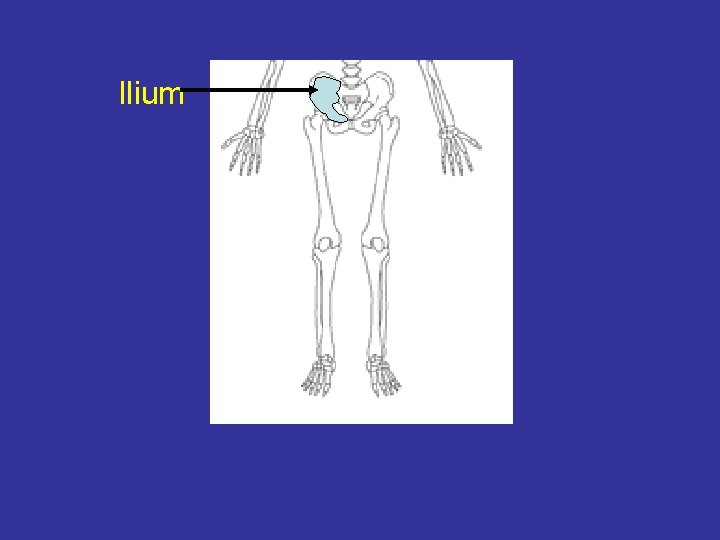 Ilium 