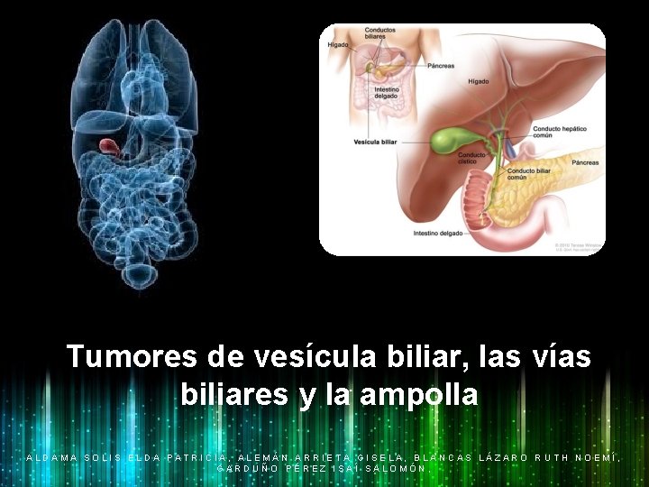 Tumores de vesícula biliar, las vías biliares y la ampolla ALDAMA SOLIS ELDA PATRICIA,