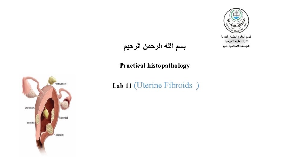  ﺑﺴﻢ ﺍﻟﻠﻪ ﺍﻟﺮﺣﻤﻦ ﺍﻟﺮﺣﻴﻢ Practical histopathology Lab 11 (Uterine Fibroids ) 