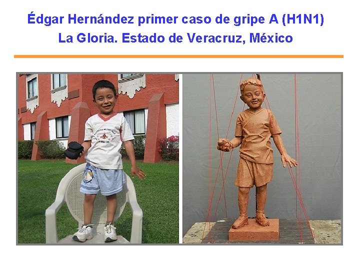 Édgar Hernández primer caso de gripe A (H 1 N 1) La Gloria. Estado