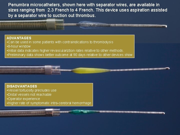 Penumbra microcatheters, shown here with separator wires, are available in sizes ranging from 2. Penumbra microcatheters, shown here with separator wires, are available in sizes ranging from 2.