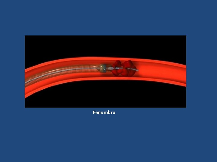 Penumbra Penumbra