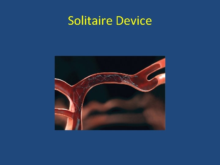 Solitaire Device 
