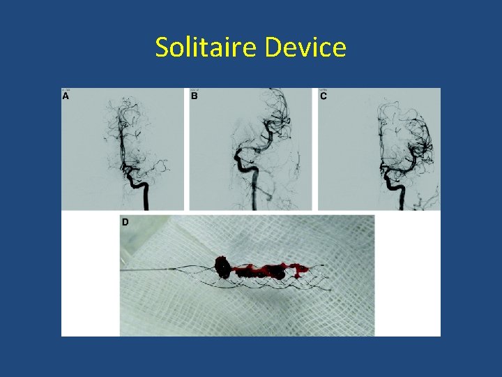Solitaire Device 