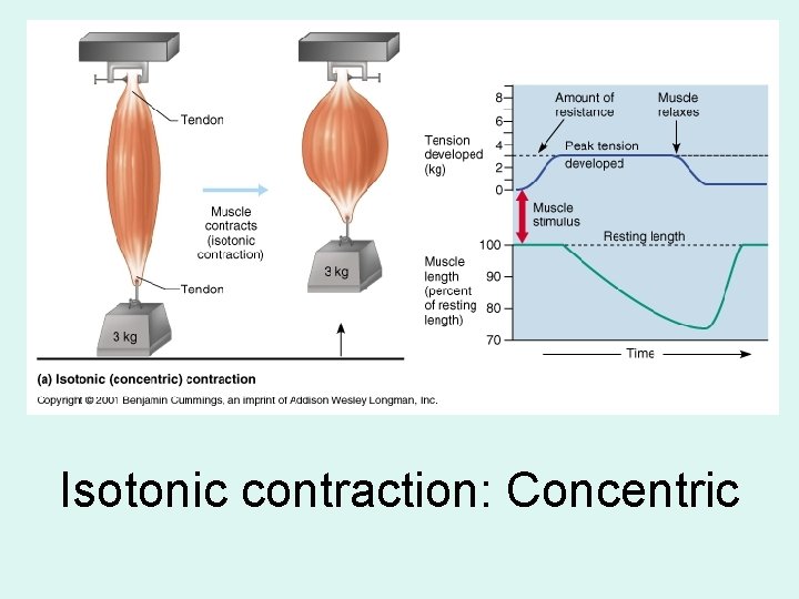 Isotonic contraction: Concentric 