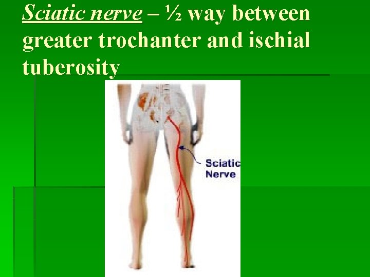 Sciatic nerve – ½ way between greater trochanter and ischial tuberosity 