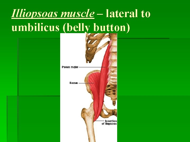 Illiopsoas muscle – lateral to umbilicus (belly button) 